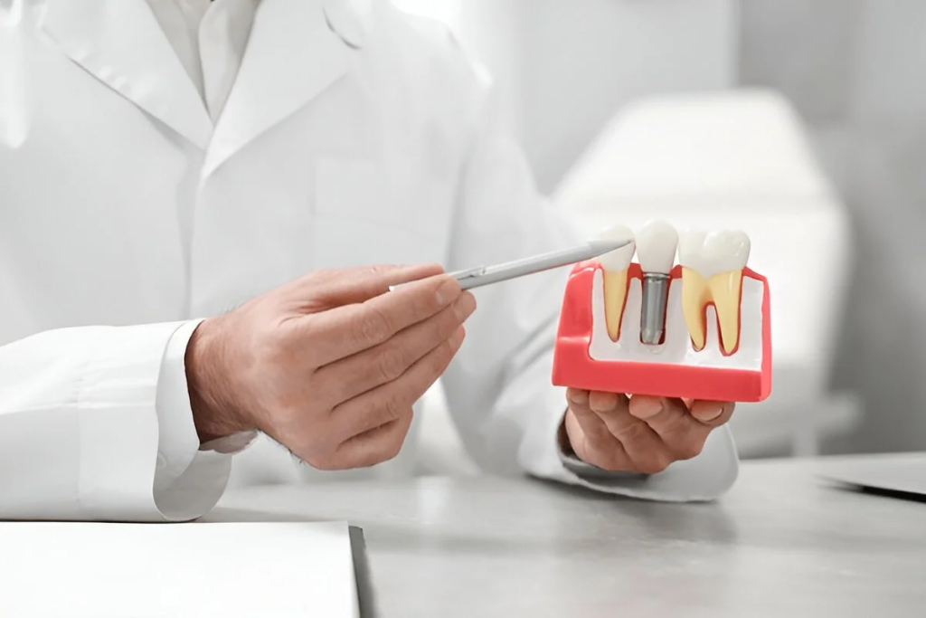 Dental Impants near me