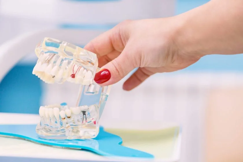 dental-implants-bellefonte-PA