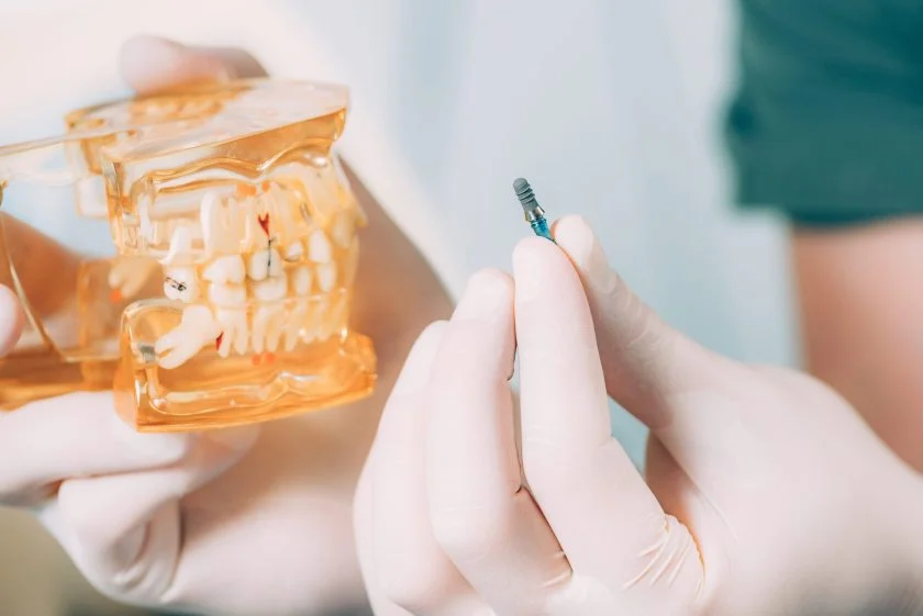 dental implants near me