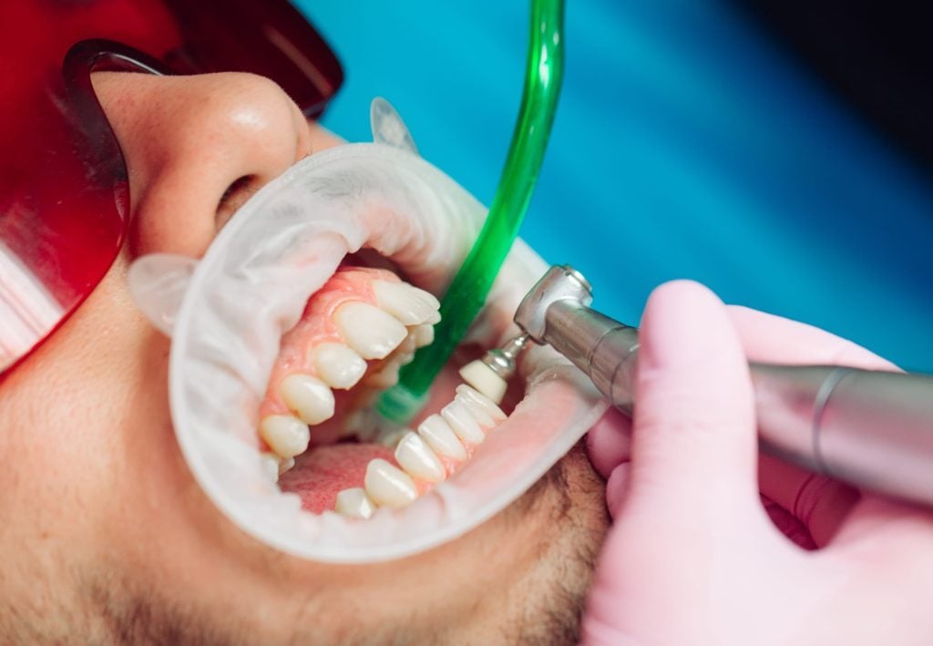 Dental Cleanings