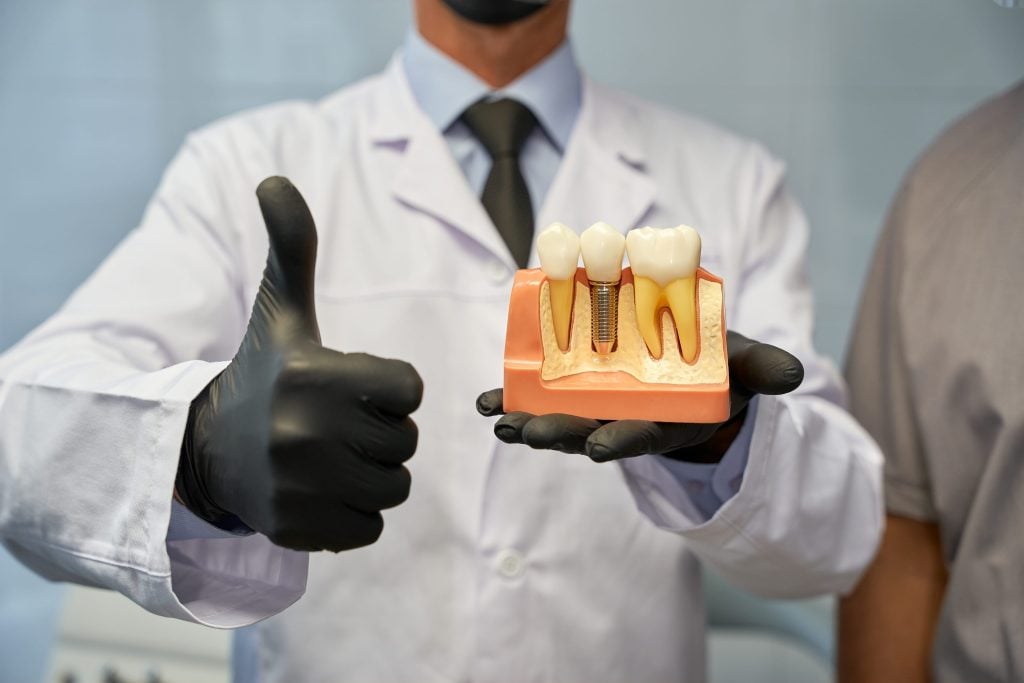 Dental Implants with low bone density
